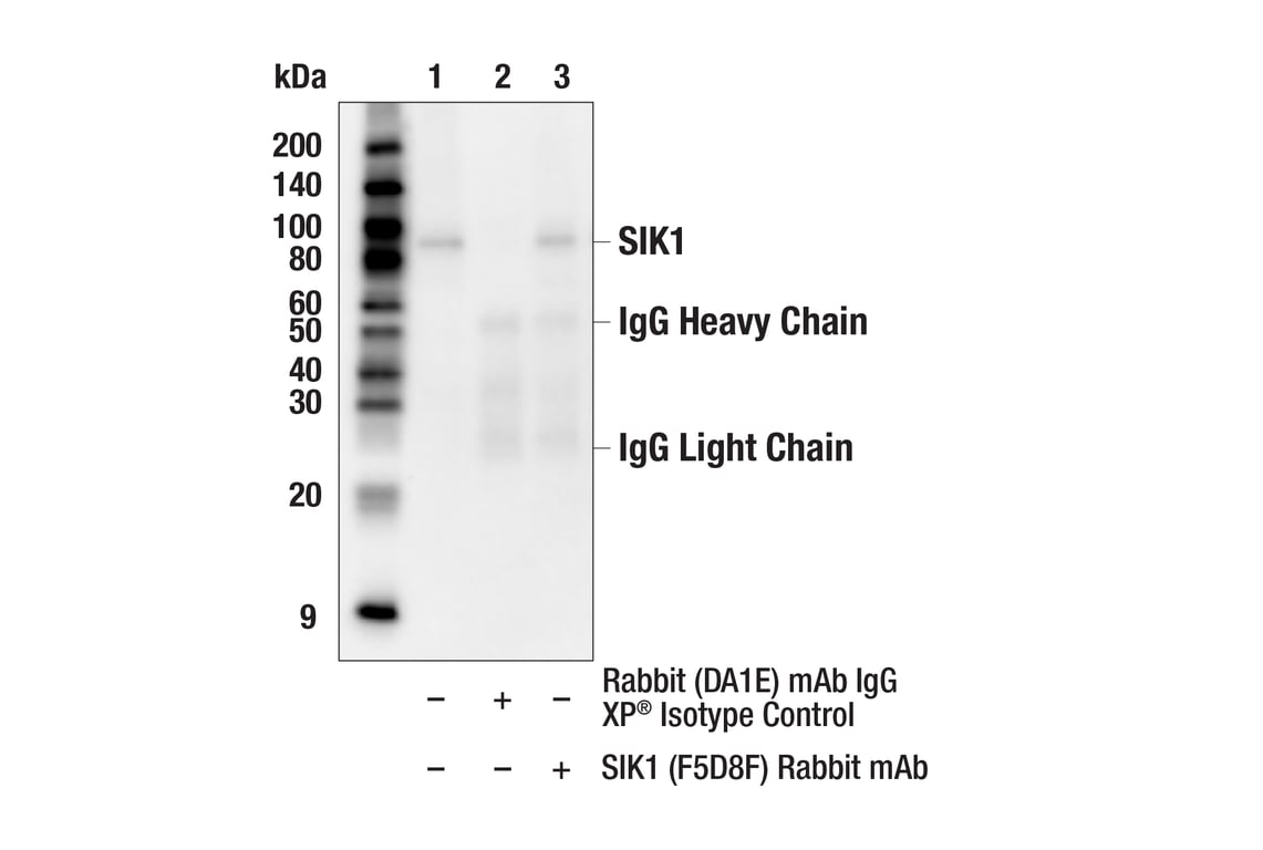 Immunoprecipitation Image 1: SIK1 (F5D8F) Rabbit Monoclonal Antibody