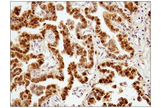 Immunohistochemistry Image 3: Stat3 (D1B2J) Rabbit Monoclonal Antibody (BSA and Azide Free)