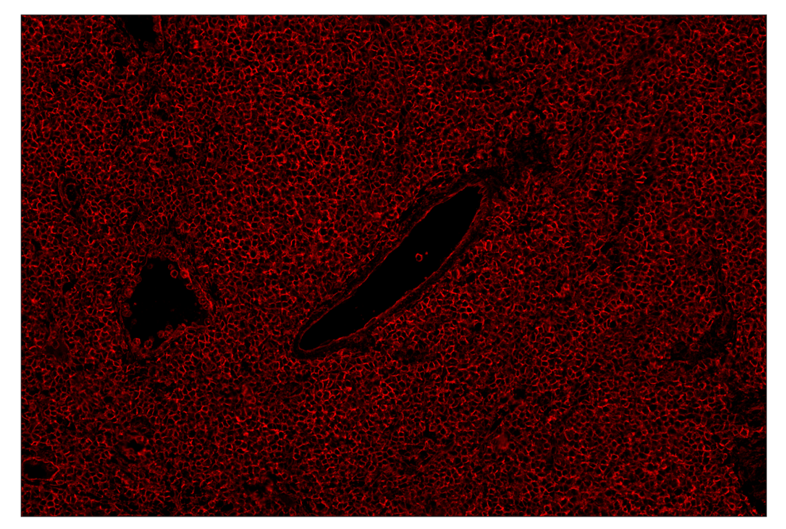 Immunohistochemistry Image 4: MHC Class I (EMR8-5) & CO-0082-647 SignalStar<sup>™</sup> Oligo-Antibody Pair