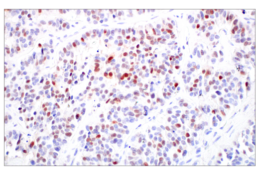 Immunohistochemistry Image 2: ASCL1 (E5S4Q) XP<sup>®</sup> Rabbit mAb