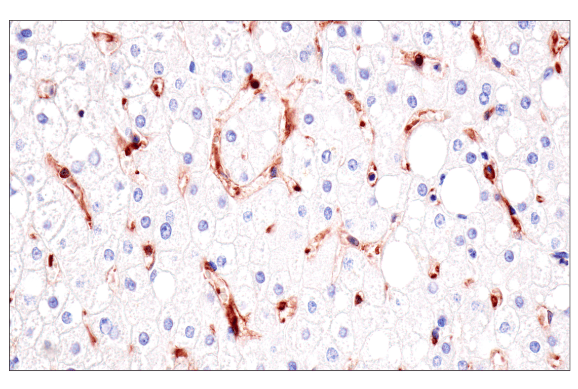 Immunohistochemistry Image 8: HLA-B (BC43) Mouse Monoclonal Antibody