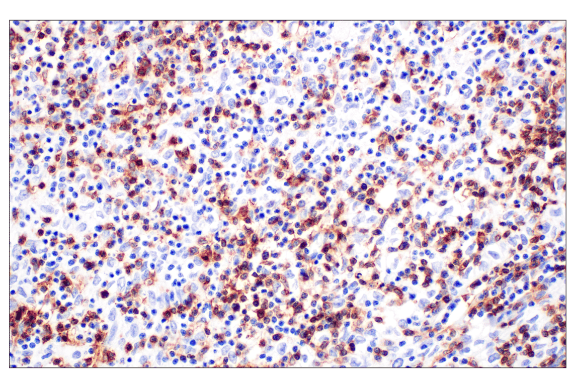 Immunohistochemistry Image 1: CD4 (MSVA-004R) Rabbit Monoclonal Antibody (BSA and Azide Free)