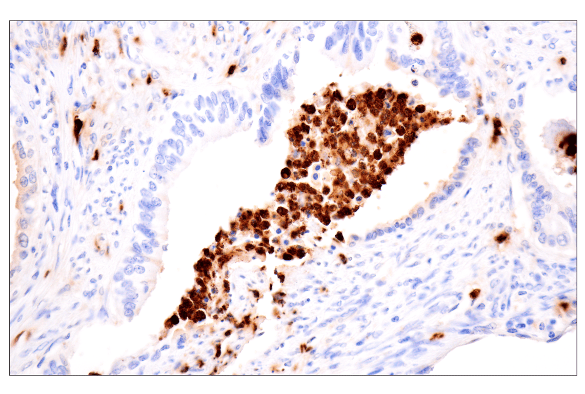 Immunohistochemistry Image 2: Neutrophil Elastase (F4H3X) Rabbit Monoclonal Antibody