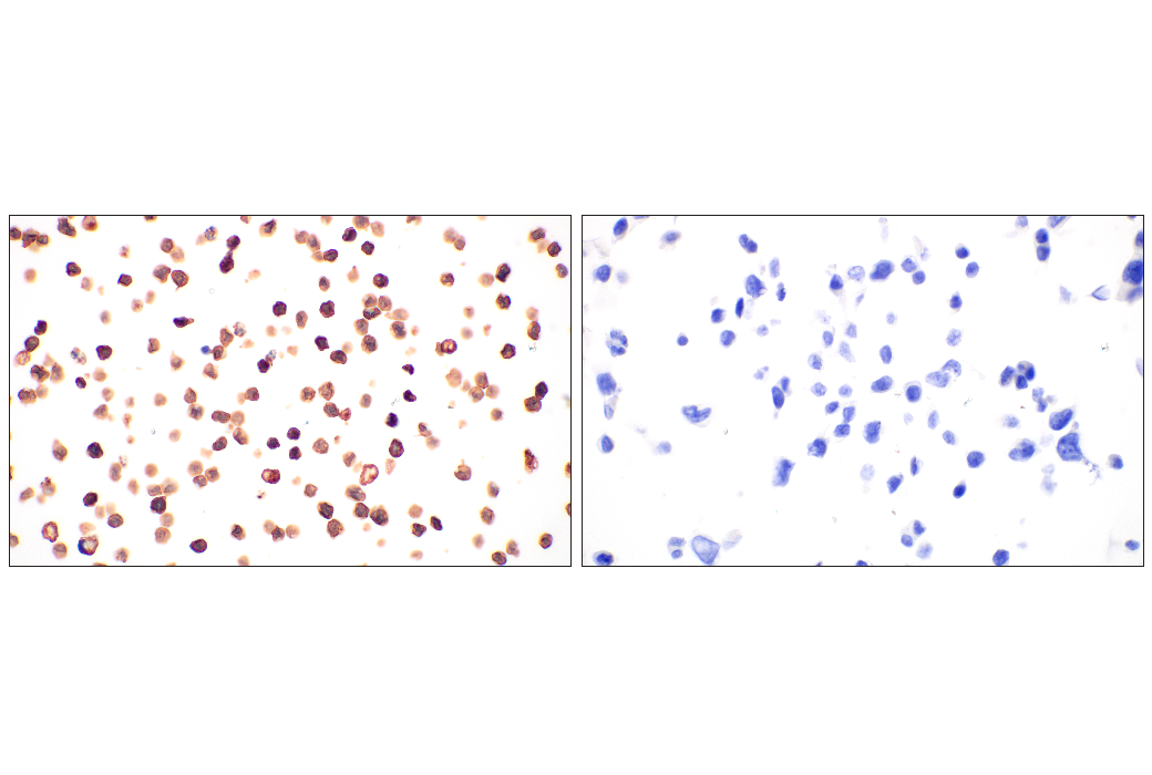 Immunohistochemistry Image 4: CD20 (E3N7O) Rabbit Monoclonal Antibody (BSA and Azide Free)