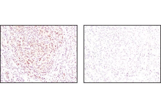 Immunohistochemistry Image 1: ASF1A (C6E10) Rabbit Monoclonal Antibody