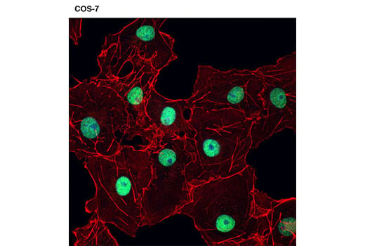 undefined Image 21: SET1/COMPASS Antibody Sampler Kit