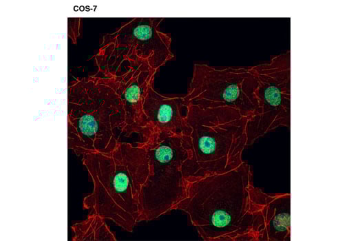 undefined Image 25: SET1/COMPASS Antibody Sampler Kit