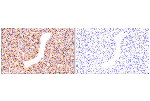 Immunohistochemistry Image 4: Parvalbumin (E8N2U) Rabbit Monoclonal Antibody (BSA and Azide Free)