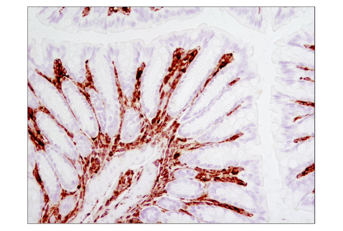 Immunohistochemistry Image 2: Vimentin (D21H3) Rabbit Monoclonal Antibody