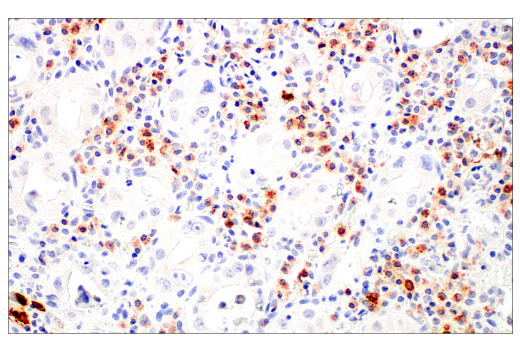Immunohistochemistry Image 1: LAMP3/CD208 (E6E5U) Rabbit Monoclonal Antibody (BSA and Azide Free)