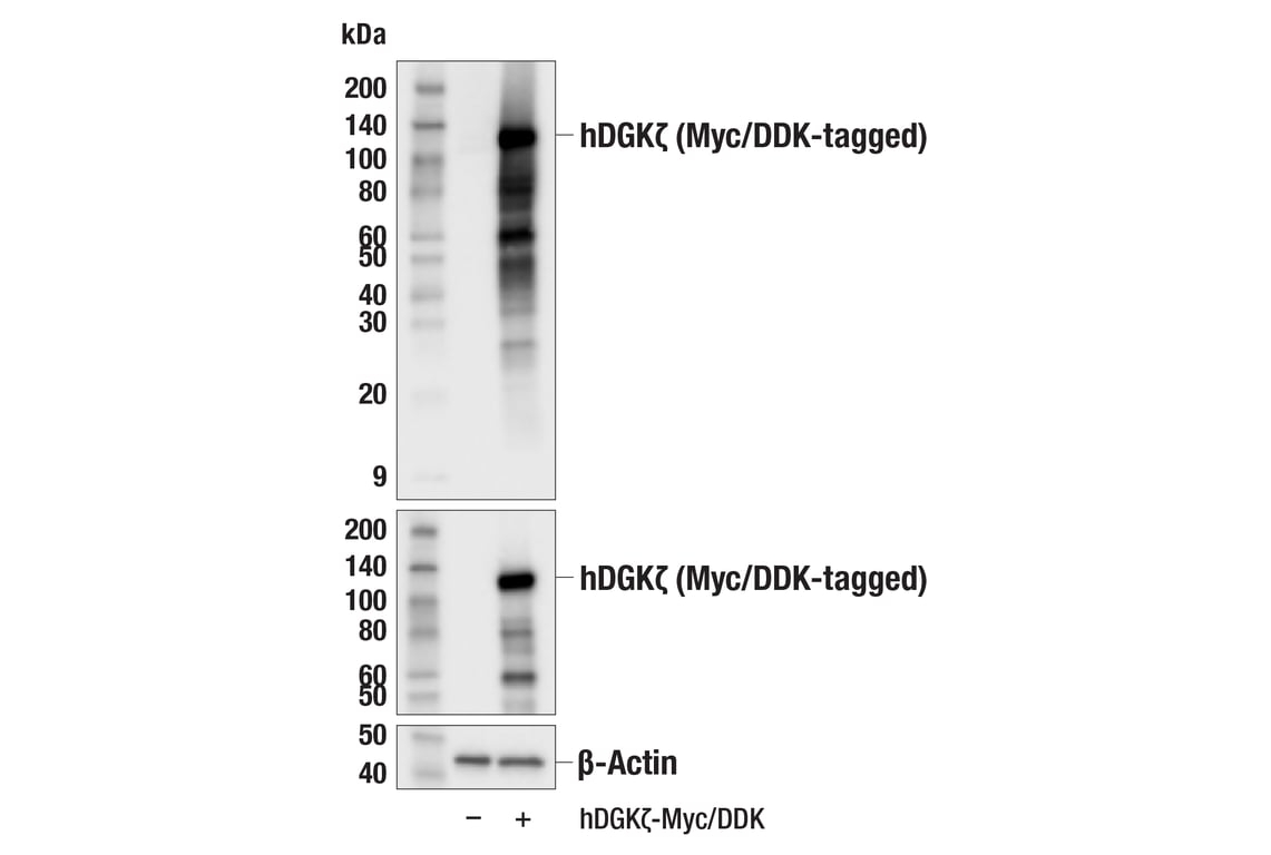 Western Blotting Image 3: DGK zeta (F6W7N) Rabbit Monoclonal Antibody