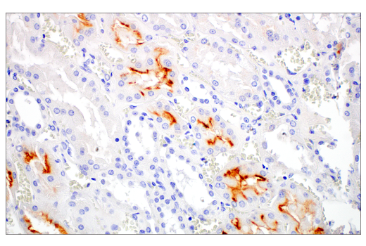 Immunohistochemistry Image 3: MUC13 (E6Z1K) Rabbit Monoclonal Antibody