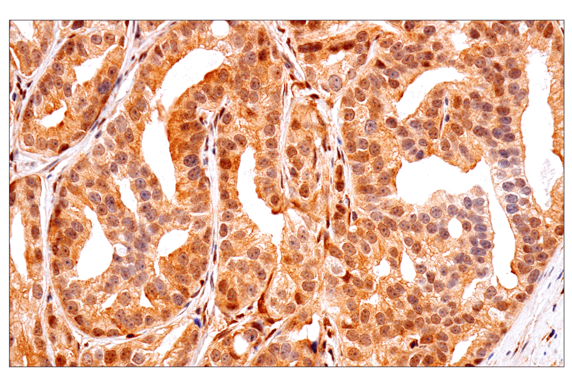Immunohistochemistry Image 2: PTEN (D4.3) Rabbit Monoclonal Antibody (BSA and Azide Free)