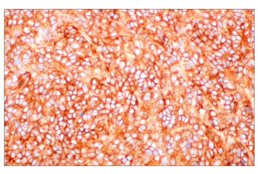 【再出品】melanin TGN38 Antibody (2F7.1) (NB300-575): Novus Biologicals