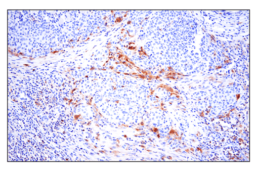 Immunohistochemistry Image 4: Phospho-SLP-76 (Ser376) (E3G9U) Rabbit Monoclonal Antibody (BSA and Azide Free)