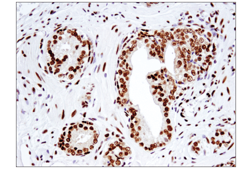 undefined Image 54: BAF Complex IHC Antibody Sampler Kit