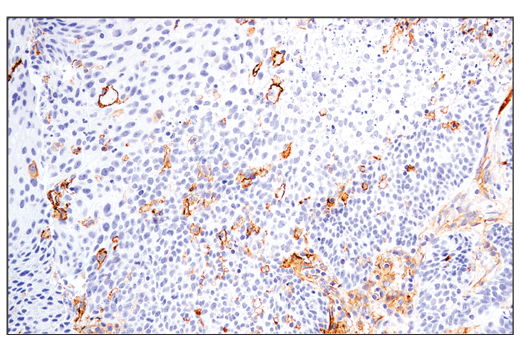 Immunohistochemistry Image 3: CD54/ICAM-1 (E3Q9N) Rabbit Monoclonal Antibody (BSA and Azide Free)