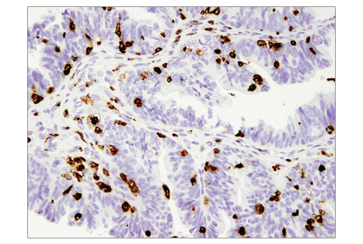 Immunohistochemistry Image 2: CD68 (D4B9C) XP<sup>®</sup> Rabbit mAb (BSA and Azide Free)