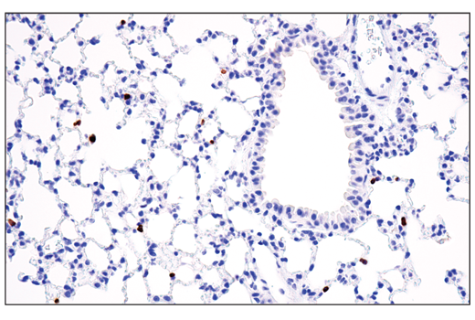 Immunohistochemistry Image 2: Perforin (E3W4I) Rabbit Monoclonal Antibody