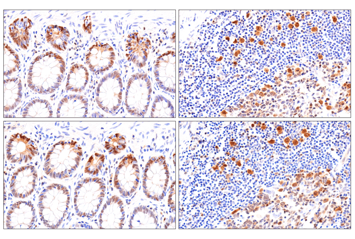 Immunohistochemistry Image 16: CDK6 (E3E3Q) Rabbit Monoclonal Antibody (BSA and Azide Free)