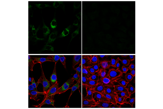 Immunofluorescence Image 1: ECM1 (E3B9A) Rabbit Monoclonal Antibody