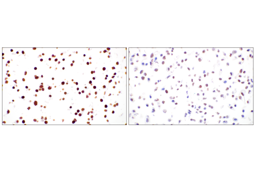 Immunohistochemistry Image 14: TIF1α/TRIM24 (E9T3N) Rabbit mAb