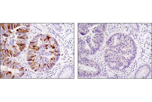 Immunohistochemistry Image 1: PLK1 (208G4) Rabbit Monoclonal Antibody