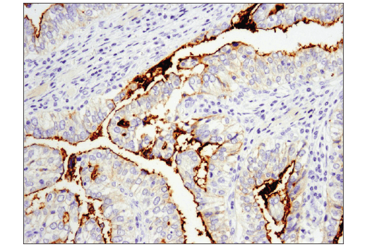 Immunohistochemistry Image 1: CD133 (D2V8Q) Rabbit Monoclonal Antibody (BSA and Azide Free)
