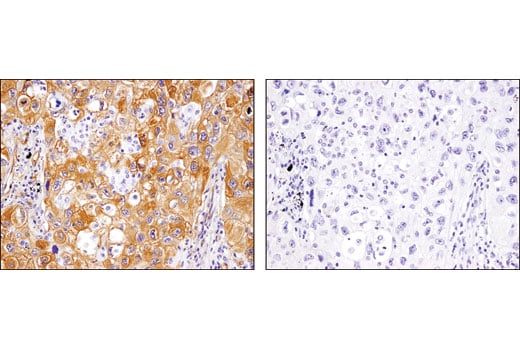 Immunohistochemistry Image 3: p130 Cas (E1L9H) Rabbit Monoclonal Antibody (BSA and Azide Free)