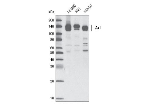 Western Blotting Image 2: Axl (C44G1) Rabbit Monoclonal Antibody