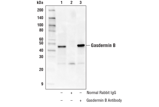 undefined Image 21: Gasdermin Family Antibody Sampler Kit