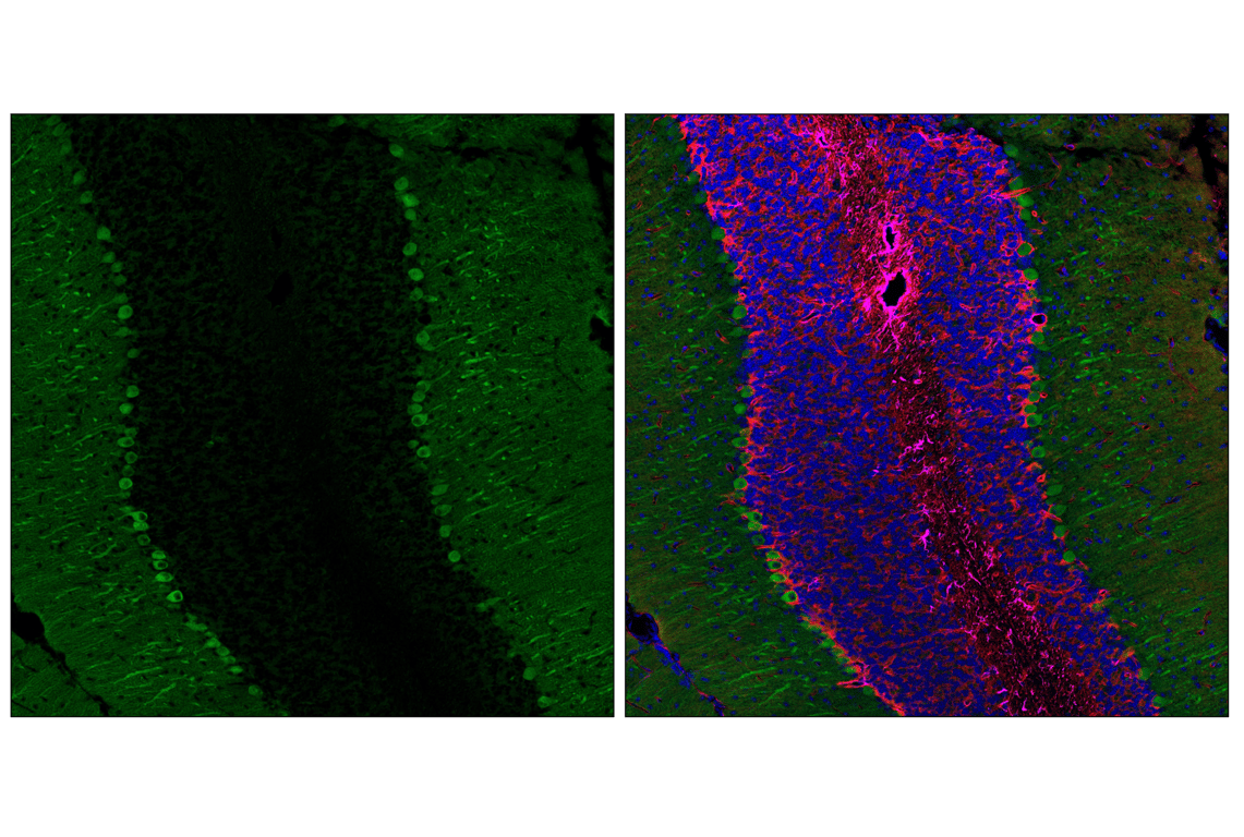 Immunofluorescence Image 1: PIP4K2C (E7P3S) Rabbit Monoclonal Antibody