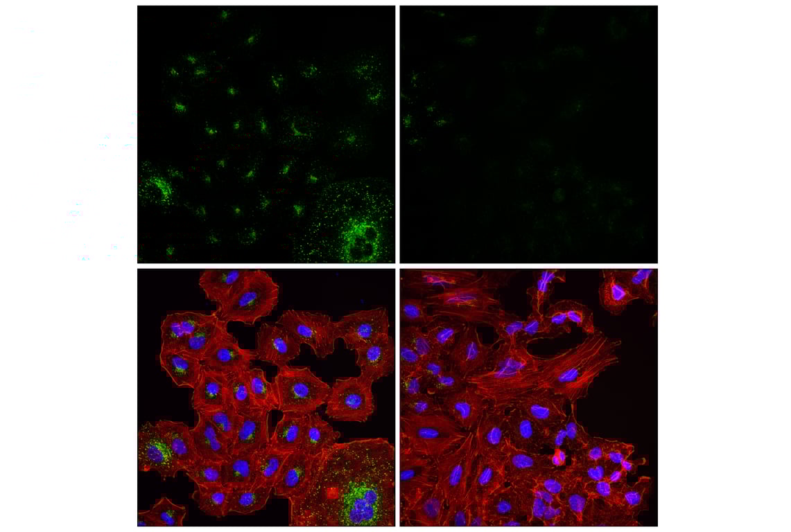Immunofluorescence Image 2: APP (E3F3P) Rabbit Monoclonal Antibody