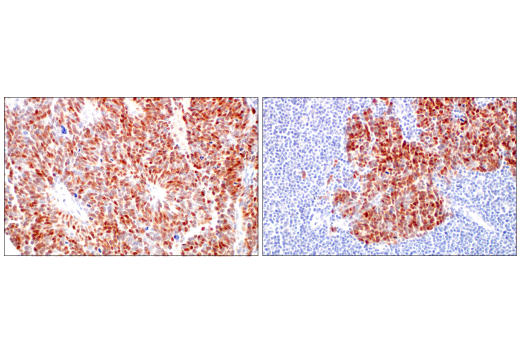 Immunohistochemistry Image 4: ASCL1 (E5S4Q) XP<sup>®</sup> Rabbit mAb