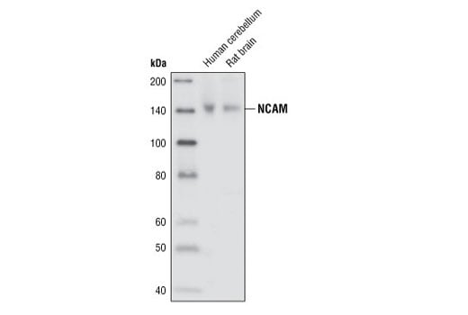 NCAM (CD56) Antibody | Cell Signaling Technology