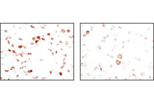 Immunohistochemistry Image 4: FoxO1 (C29H4) Rabbit Monoclonal Antibody (BSA and Azide Free)