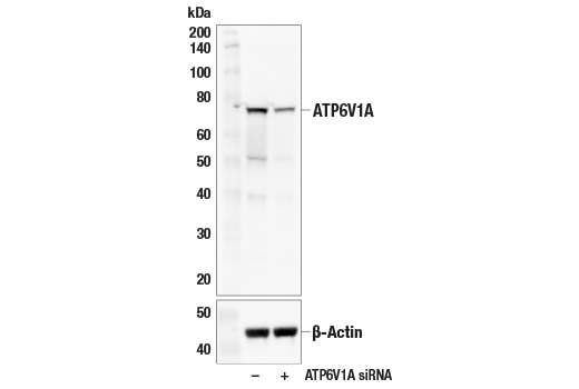 Western Blotting Image 2: ATP6V1A (E5N9E) Rabbit Monoclonal Antibody