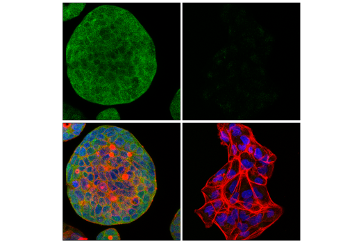 Immunofluorescence Image 1: Syk (D1I5Q) Rabbit Monoclonal Antibody
