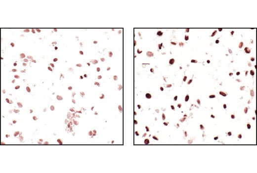 Immunohistochemistry Image 3: Acetylated-Lysine Antibody