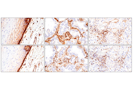 Immunohistochemistry Image 11: CD99 (PCB1) Mouse mAb