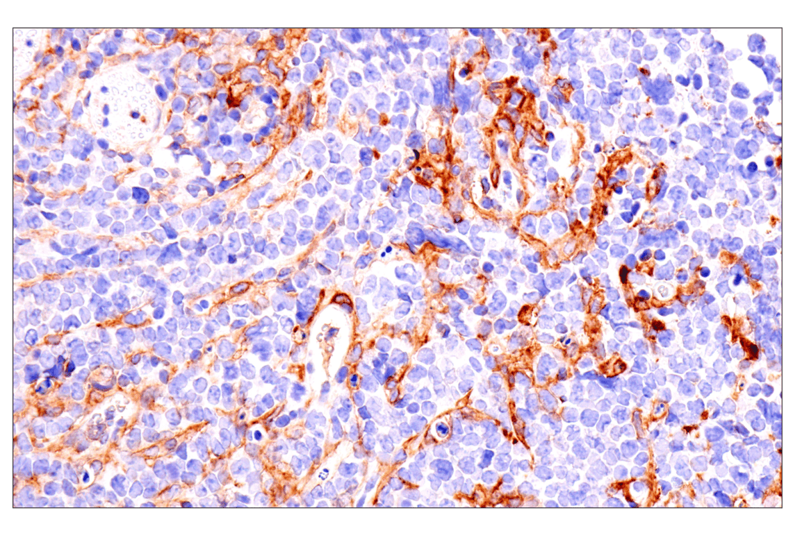 Immunohistochemistry Image 1: Axl (E3Z2H) Rabbit Monoclonal Antibody (BSA and Azide Free)