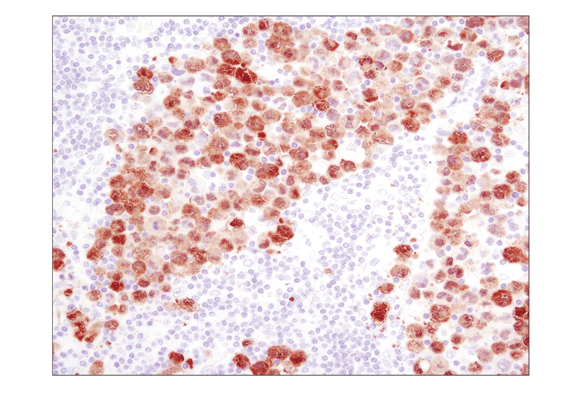 Immunohistochemistry Image 2: ALK (D5F3) Rabbit Monoclonal Antibody