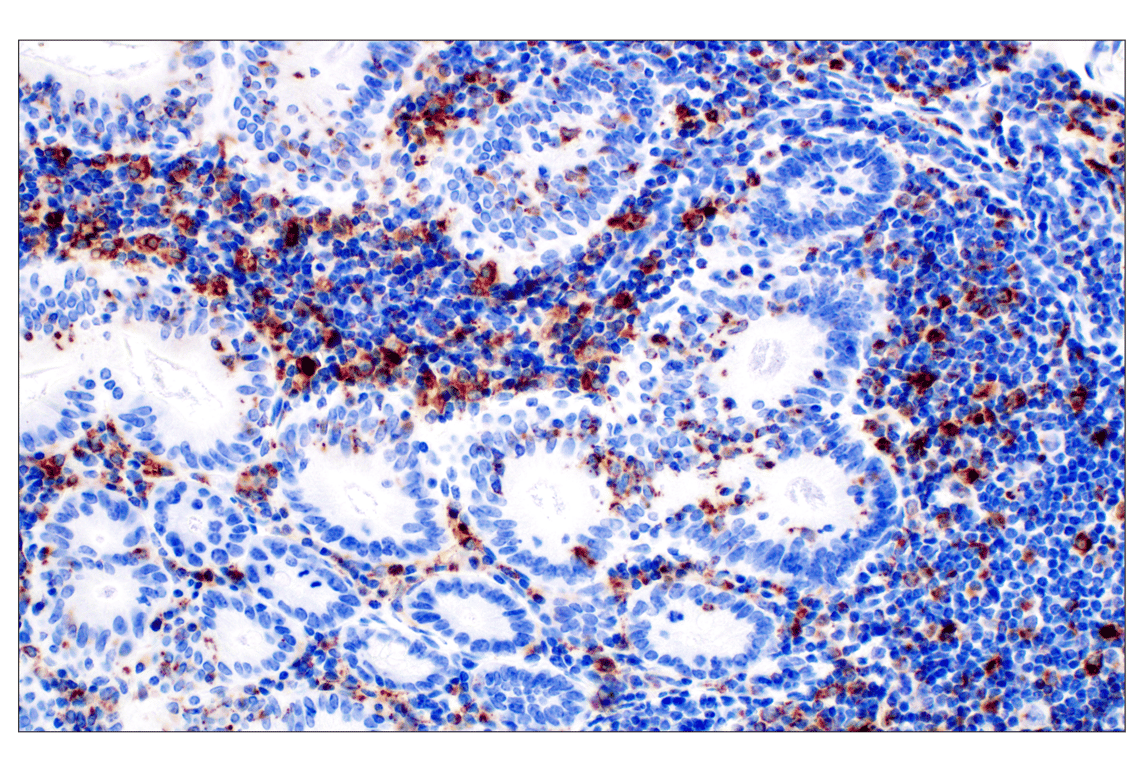 Immunohistochemistry Image 6: CD68 (E3O7V) Rabbit mAb