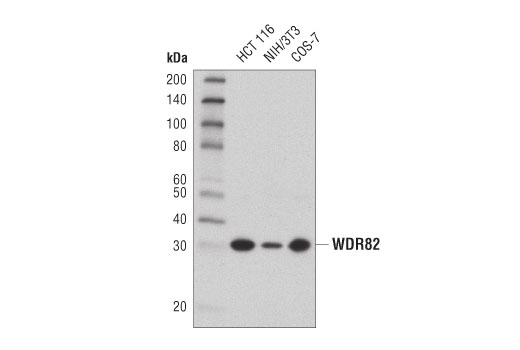 undefined Image 12: SET1/COMPASS Antibody Sampler Kit