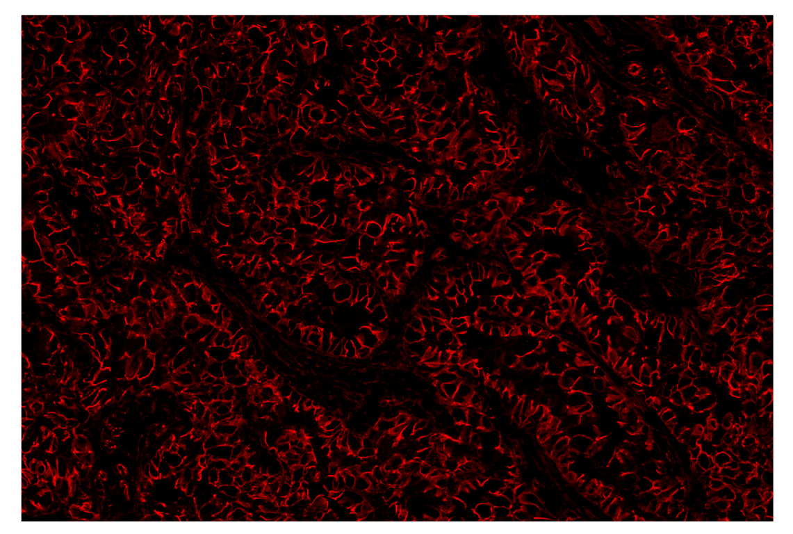 Immunohistochemistry Image 3: beta-Catenin (D10A8) & CO-0108-750 SignalStar<sup>™</sup> Oligo-Antibody Pair