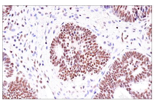 Immunohistochemistry Image 1: USP39 (E8U2M) Rabbit Monoclonal Antibody