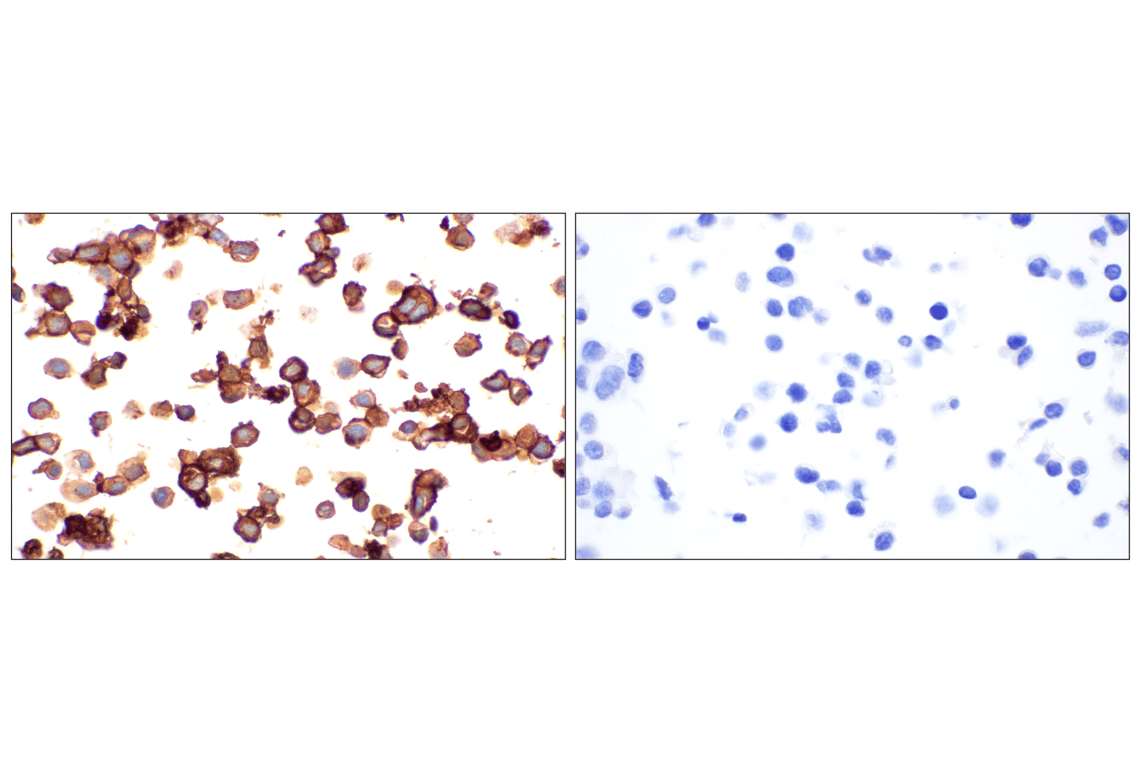 Immunohistochemistry Image 7: MAdCAM-1 (E1V8F) Rabbit Monoclonal Antibody (BSA and Azide Free)