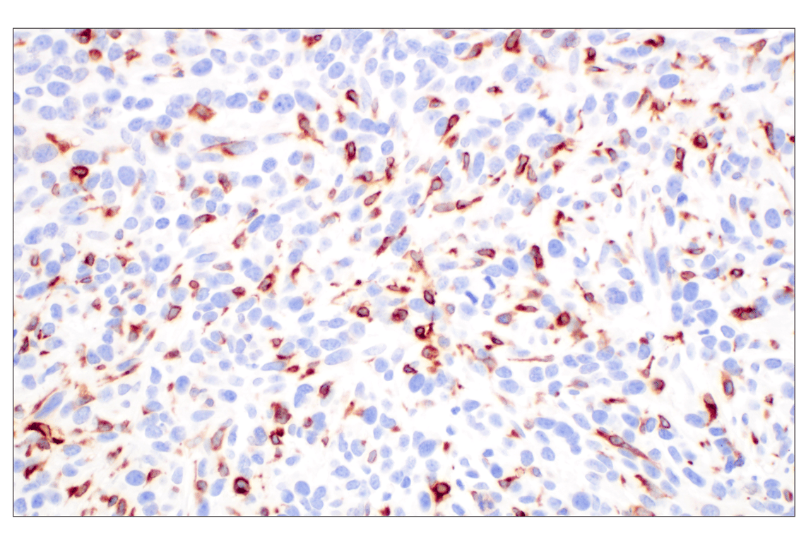 Immunohistochemistry Image 2: CD74 (F3R3L) Rabbit Monoclonal Antibody