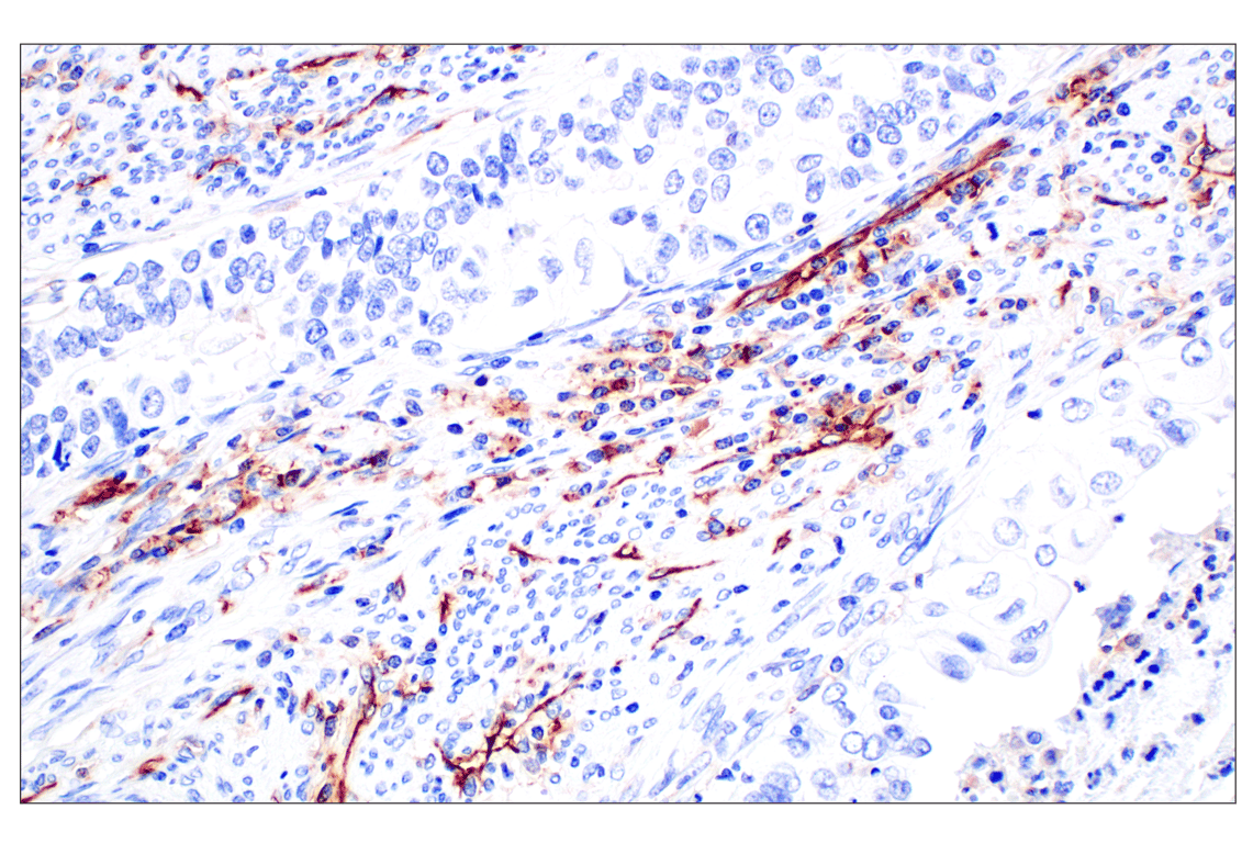 Immunohistochemistry Image 9: CD31 (PECAM-1) (F8M3S) Rabbit Monoclonal Antibody