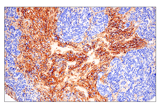 Immunohistochemistry Image 1: Fibronectin/FN1 (E5H6X) Rabbit Monoclonal Antibody (BSA and Azide Free)
